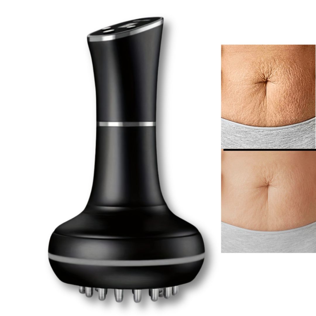 Handheld Electric Lymphatic Drainage & Anti-Cellulite Massager