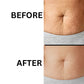Electric Cellulite Massager, Portable Lymphatic Drainage Device
